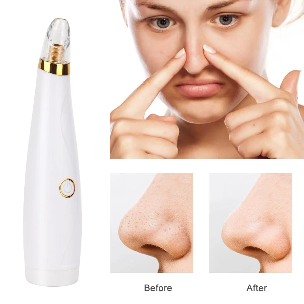 Electric Acne Cleaner Black Point Vacuum Cleaner Tool