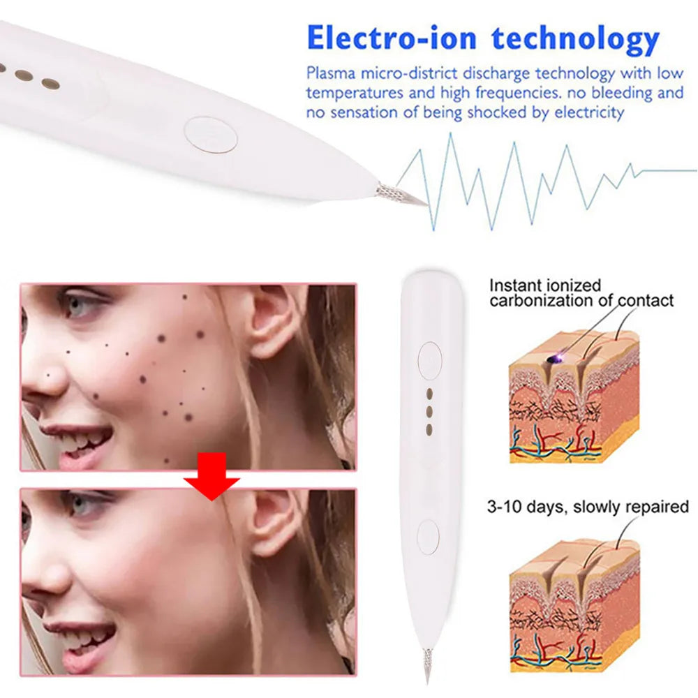 Freckle Remove Facial Skin Tag Removal Spot Cleaner Beauty Pen