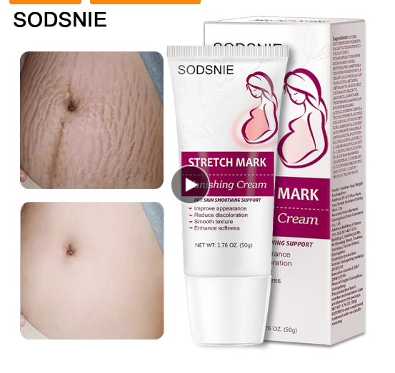 Stretch Mark Vanishing Cream Pregnant Women Stretch Marks